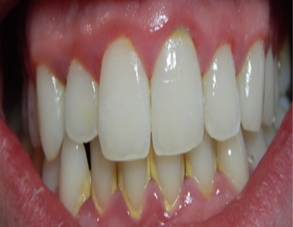 Una odontòloga examina les dents d'un pacient