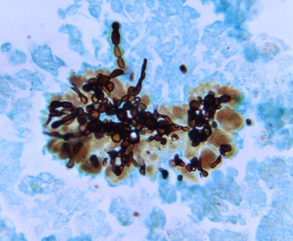 Vista microscòpica del fong Candida