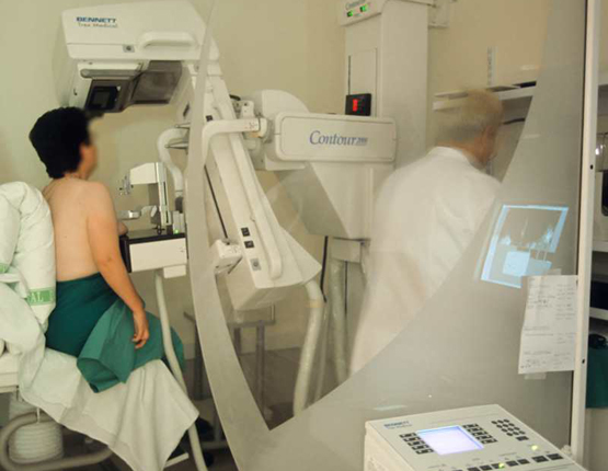 Un aparell de mamografia