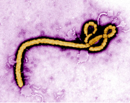Febre hemorràgica per virus Ebola