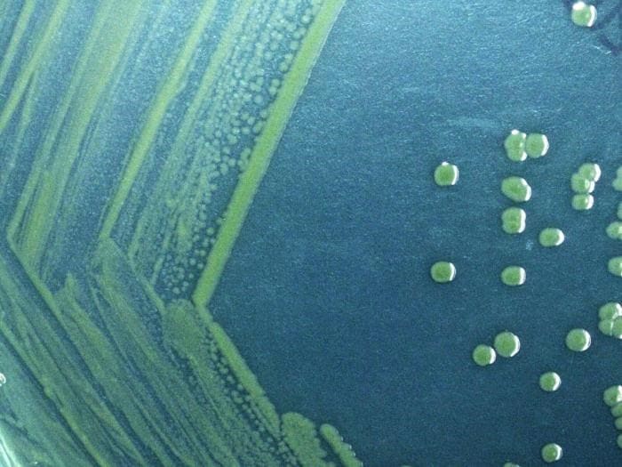 Vista microscòpica dels bacteris Shigella