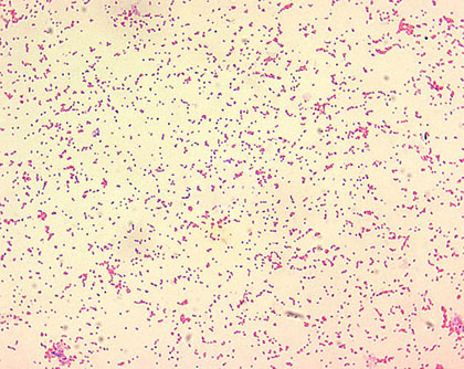 Vista microscòpica del bacteri Brucella, causant de la malaltia