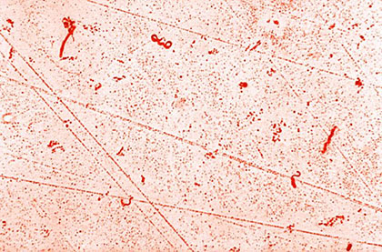 Vista microscòpica del bacteri Campylobacter, responsable de la campilobacteriosi