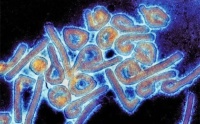 Vista microscòpica del virus de Marburg