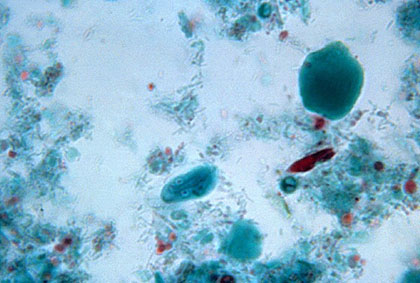 Vista microscòpica del paràsit Giardia intestinalis