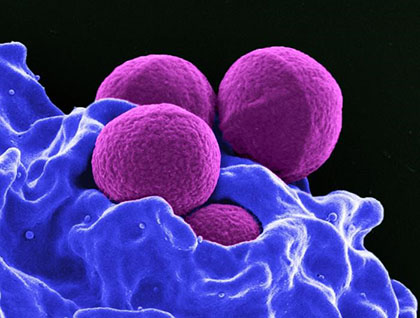 Vista microscòpica del bacteri Staphylococcus