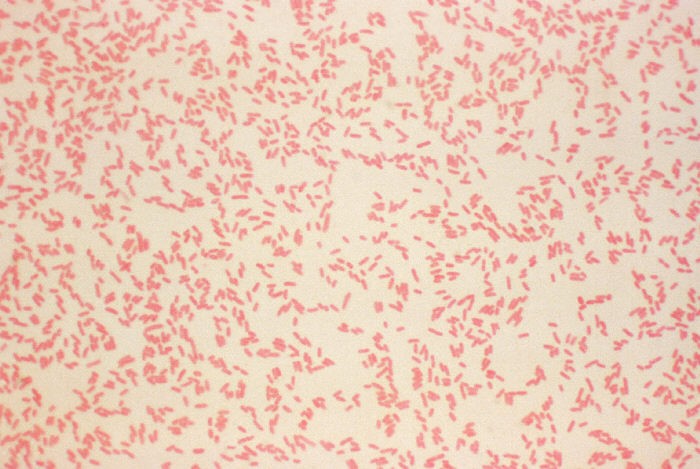 Vista microscòpica dels bacteris causants de la yersiniosi