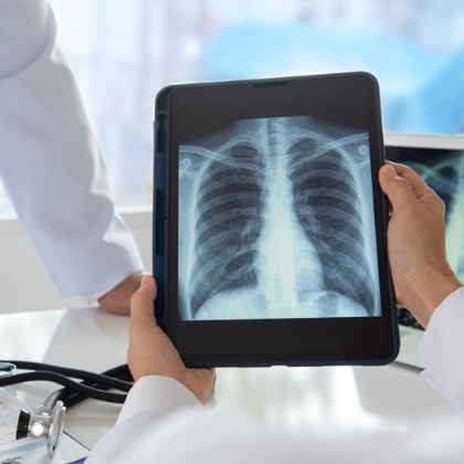 Un professional sanitari observa una radiografia de pulmons des d'una tauleta