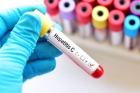 Setmana Europea de les Proves del VIH-Hepatitis