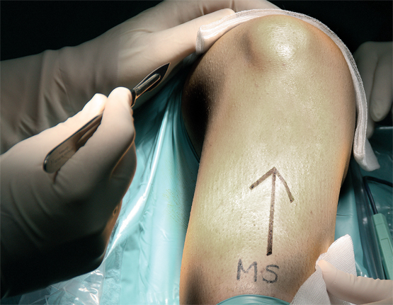 Prevenir errors en els procediments
