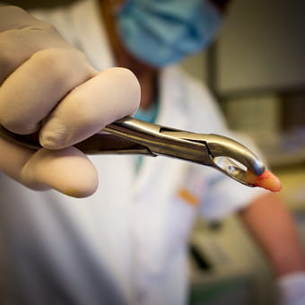 Un odontòleg sosté una peça dental que acaba d'extreure