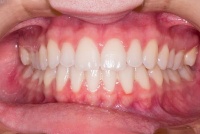 La boca i les dents