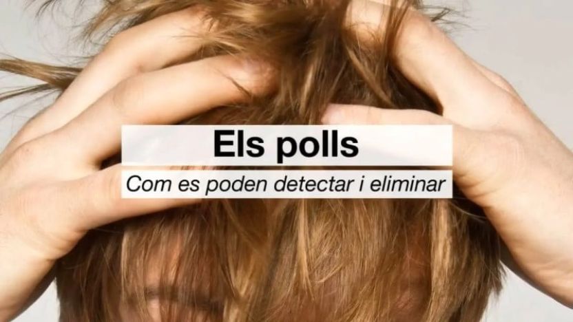 Els polls, com detectar-los, com evitar el contagi i com eliminar-los