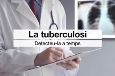 La tuberculosi, què n'has de saber